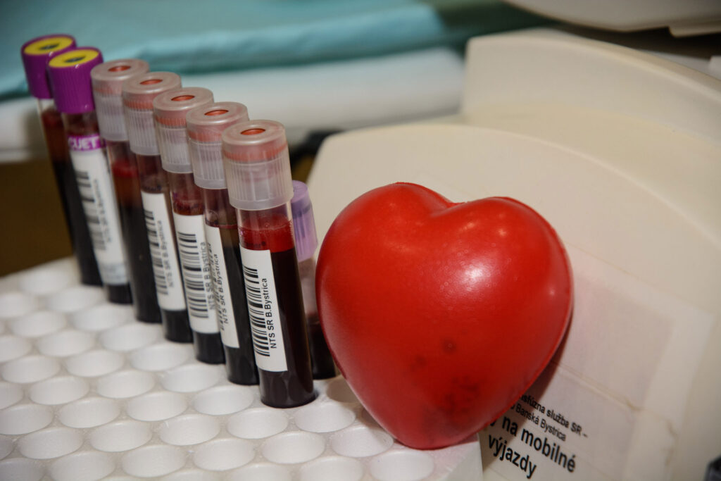 softipacka-kvapka-krvi-2018-13